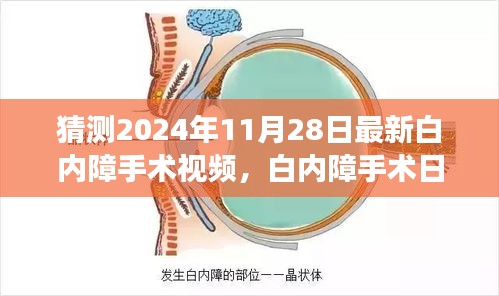 白內(nèi)障手術(shù)最新進(jìn)展揭秘，溫馨之旅中的小驚喜，白內(nèi)障手術(shù)日精彩瞬間回顧（附最新視頻）