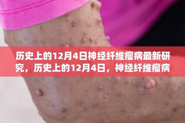 歷史上的神經(jīng)纖維瘤病研究之旅，與自然美景共舞，探尋內(nèi)心寧靜港灣的新突破