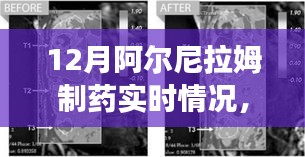 阿爾尼拉姆制藥12月實時動態(tài)，生產(chǎn)進展、市場洞察一覽無余