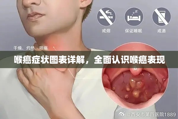 喉癌癥狀圖表詳解，全面認(rèn)識(shí)喉癌表現(xiàn)