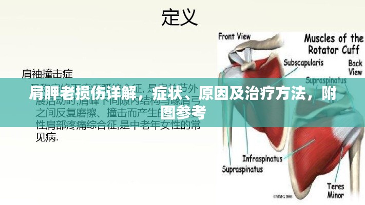 肩胛老損傷詳解，癥狀、原因及治療方法，附圖參考