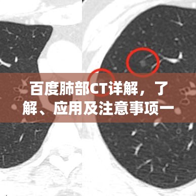 百度肺部CT詳解，了解、應(yīng)用及注意事項(xiàng)一網(wǎng)打盡
