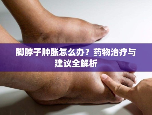 腳脖子腫脹怎么辦？藥物治療與建議全解析