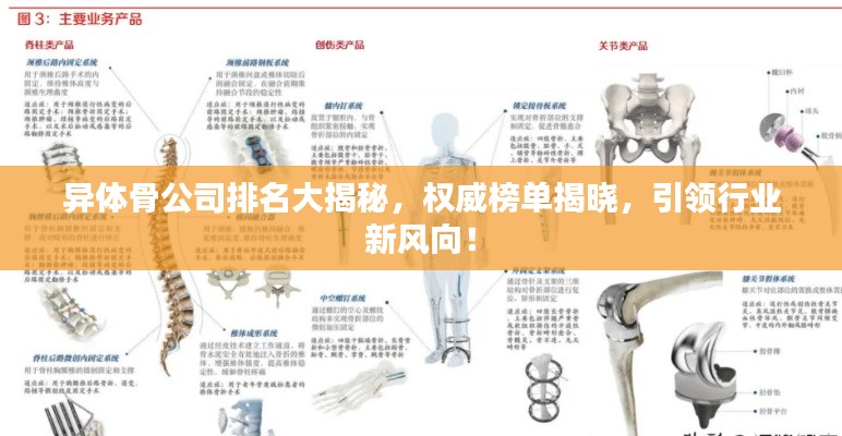 異體骨公司排名大揭秘，權(quán)威榜單揭曉，引領(lǐng)行業(yè)新風(fēng)向！